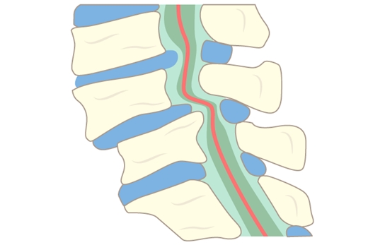 脊柱管の画像